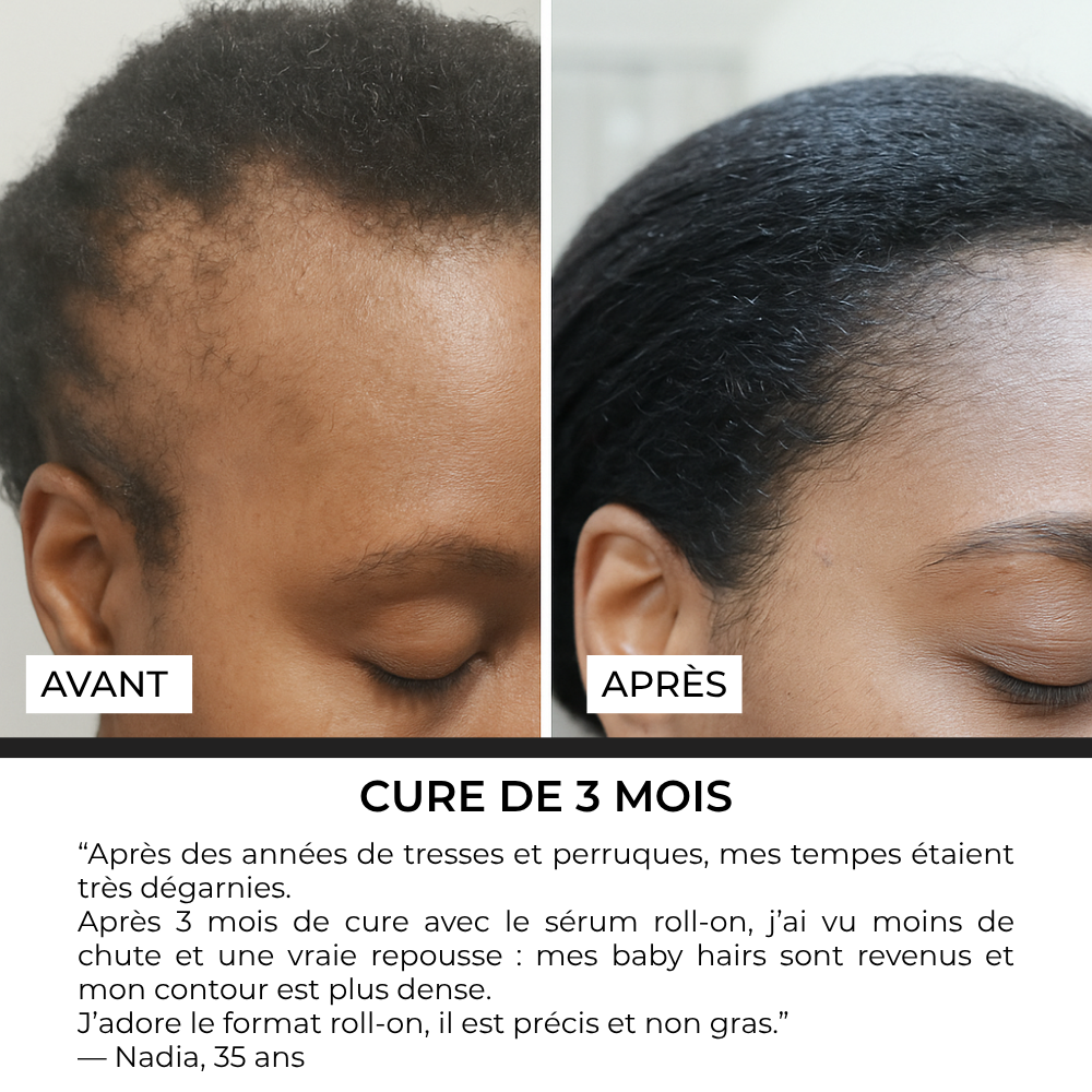 Sérum Roll-on Anti-Chute Ciblé