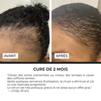 Sérum Roll-on Anti-Chute Ciblé