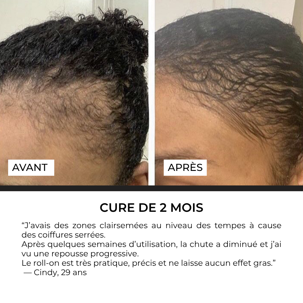 Sérum Roll-on Anti-Chute Ciblé