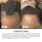 Sérum Roll-on Anti-Chute Ciblé