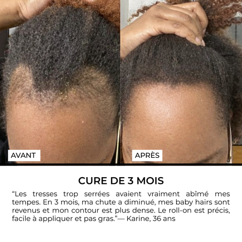 Sérum Roll-on — Formulé pour les cheveux texturés