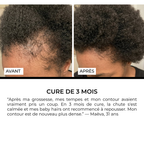 Sérum Roll-on Anti-Chute Ciblé