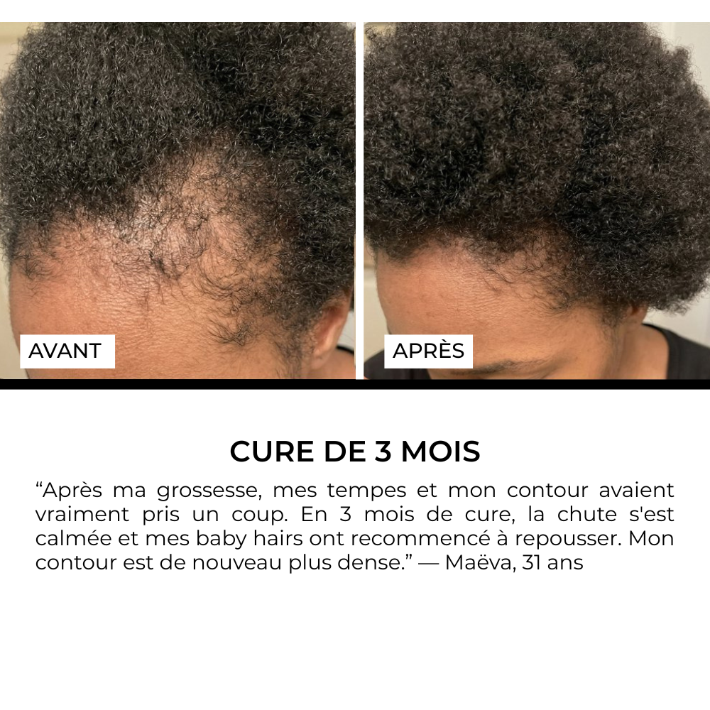 Sérum Roll-on Anti-Chute Ciblé