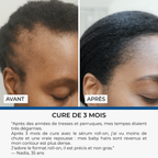 Sérum Roll-on Anti-Chute Ciblé