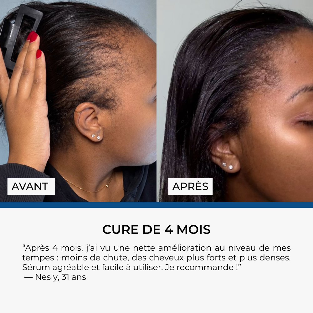 Sérum Roll-on Anti-Chute Ciblé