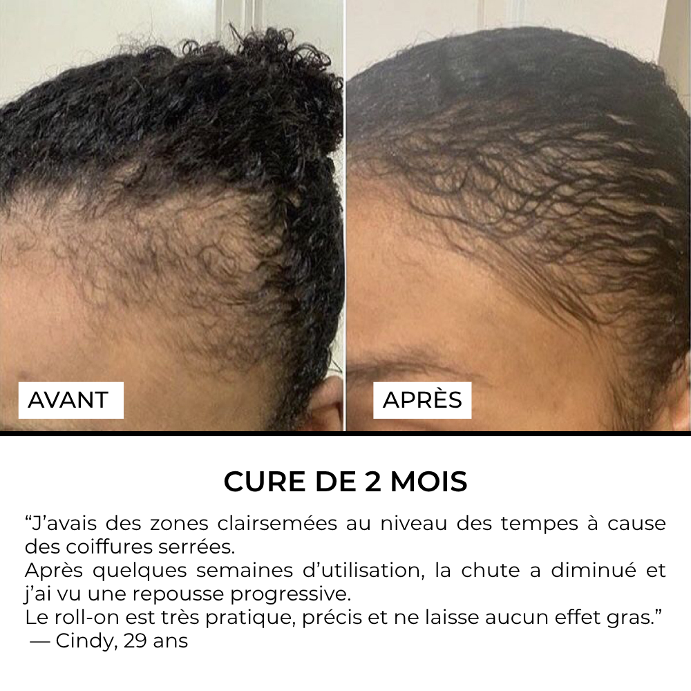 Sérum Roll-on — Formulé pour les cheveux texturés